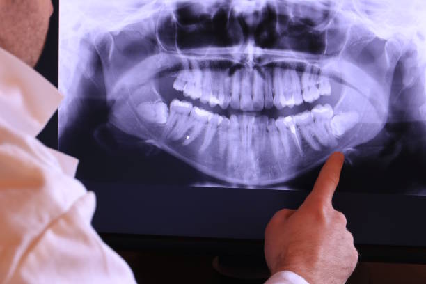 Best Emergency Root Canal Treatment in Taylor Mill, KY